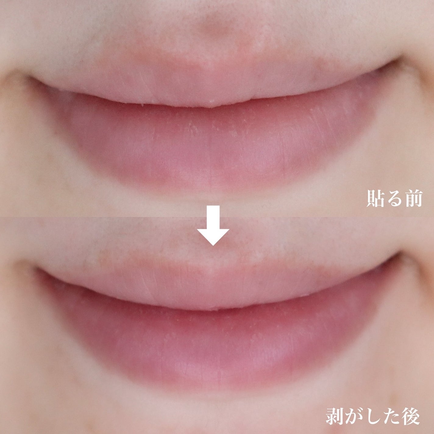 リップパック ふっくらハリ感タイプ<ハーバルハニーの香り>/CHOOSY/リップマスクを使ったクチコミ(10枚目)