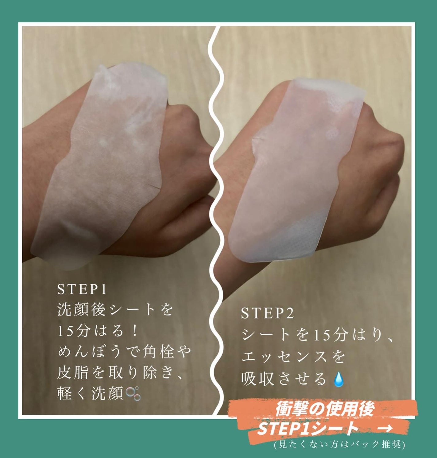 ティーツリーC鼻パック/BRING GREEN/シートマスク・パックを使ったクチコミ(8枚目)