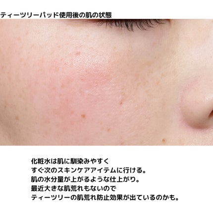 ティーツリー トラブルパッド/MEDIHEAL/トナーパッドを使ったクチコミ(6枚目)
