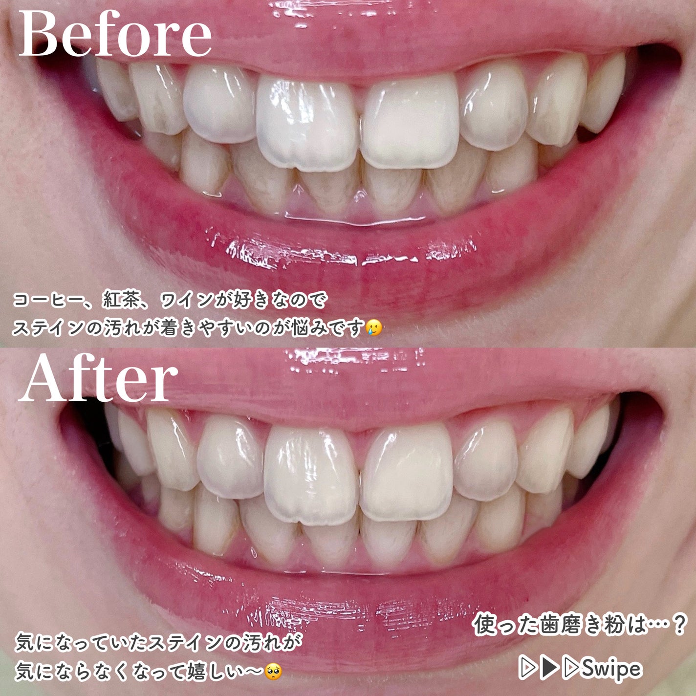 アパガードプレミオ/アパガード/歯磨き粉を使ったクチコミ(2枚目)