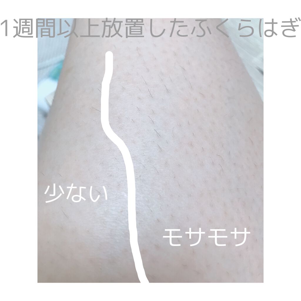 光美容器KE-NON(ケノン)/エムテック/家庭用脱毛器を使ったクチコミ(3枚目)