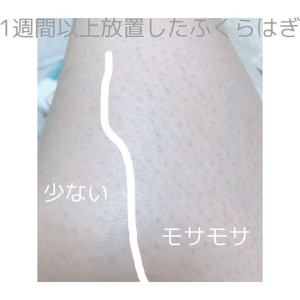 光美容器KE-NON(ケノン)/エムテック/家庭用脱毛器を使ったクチコミ(3枚目)