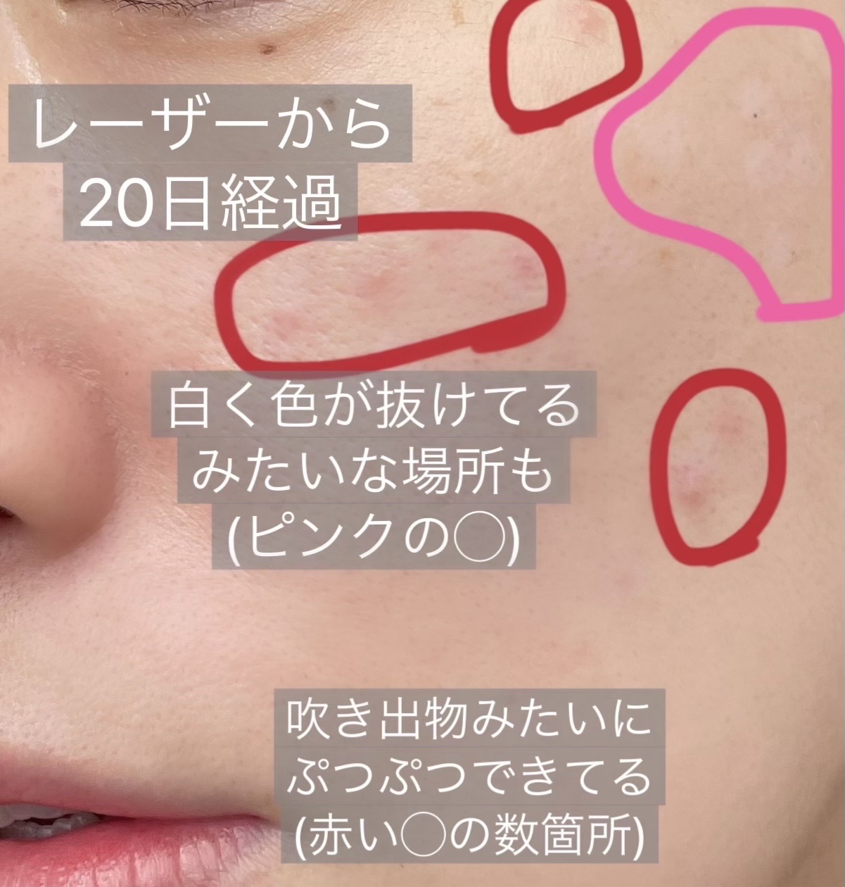 セラミドウォータージェルクリーム/BIOHEAL BOH/フェイスクリームを使ったクチコミ（2枚目）