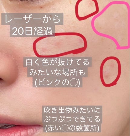 5番 白玉グルタチオンC美容液/numbuzin/美容液を使ったクチコミ(2枚目)