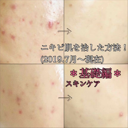バランシングライントラベルセット/エトヴォス/トライアルキットを使ったクチコミ(1枚目)