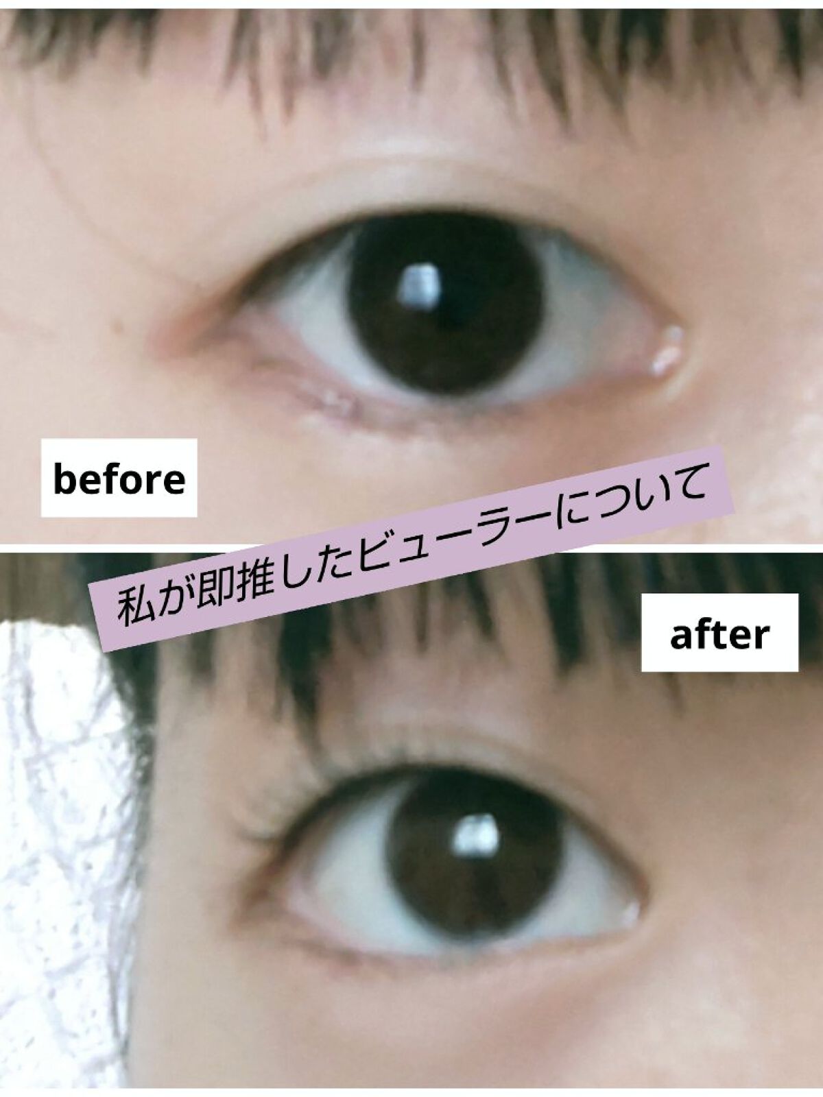 ひとえ・奥ぶたえ用カーラー/アイプチ®/ビューラーを使ったクチコミ（1枚目）