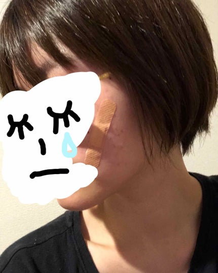 敏感肌用薬用美白化粧水・高保湿タイプ/無印良品/化粧水を使ったクチコミ(3枚目)