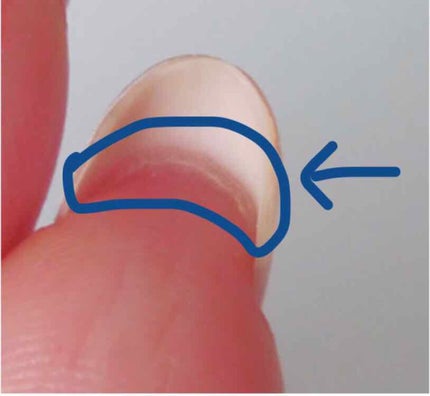 ネイルベッドオイル/アンドネイル/ネイルオイル・トリートメントを使ったクチコミ(2枚目)