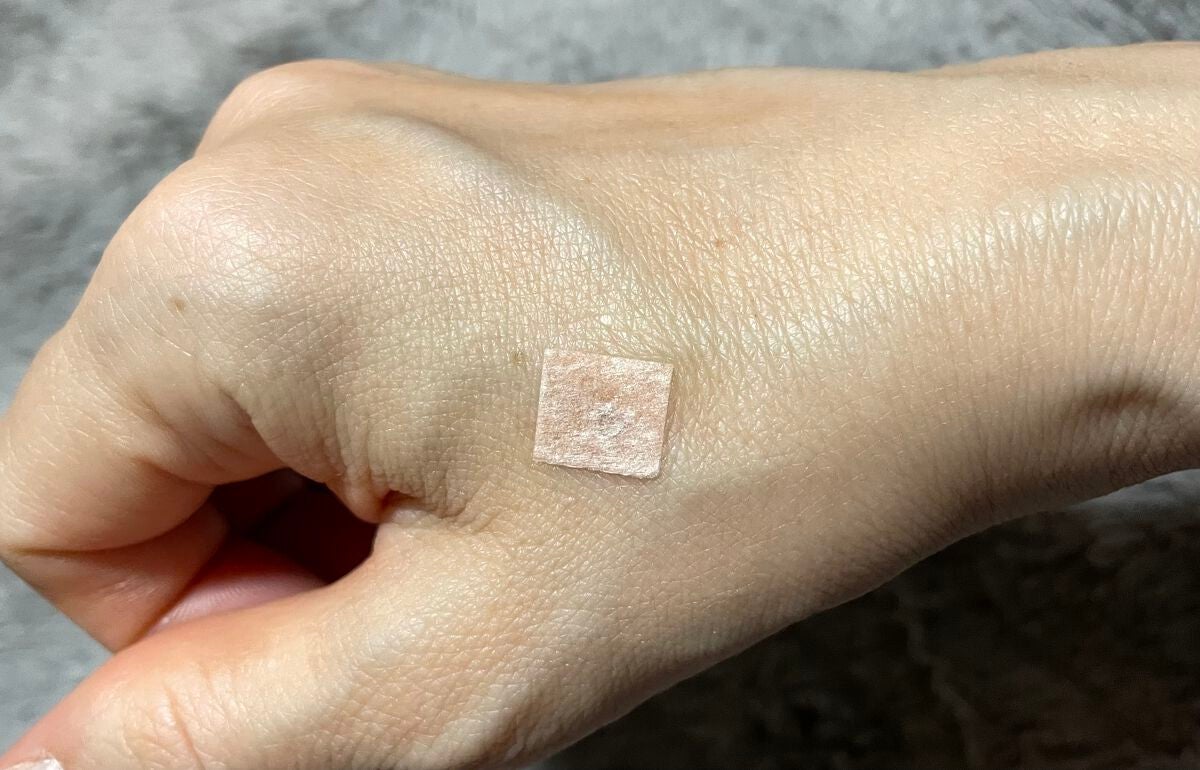 円皮鍼/ファロス/その他を使ったクチコミ(6枚目)