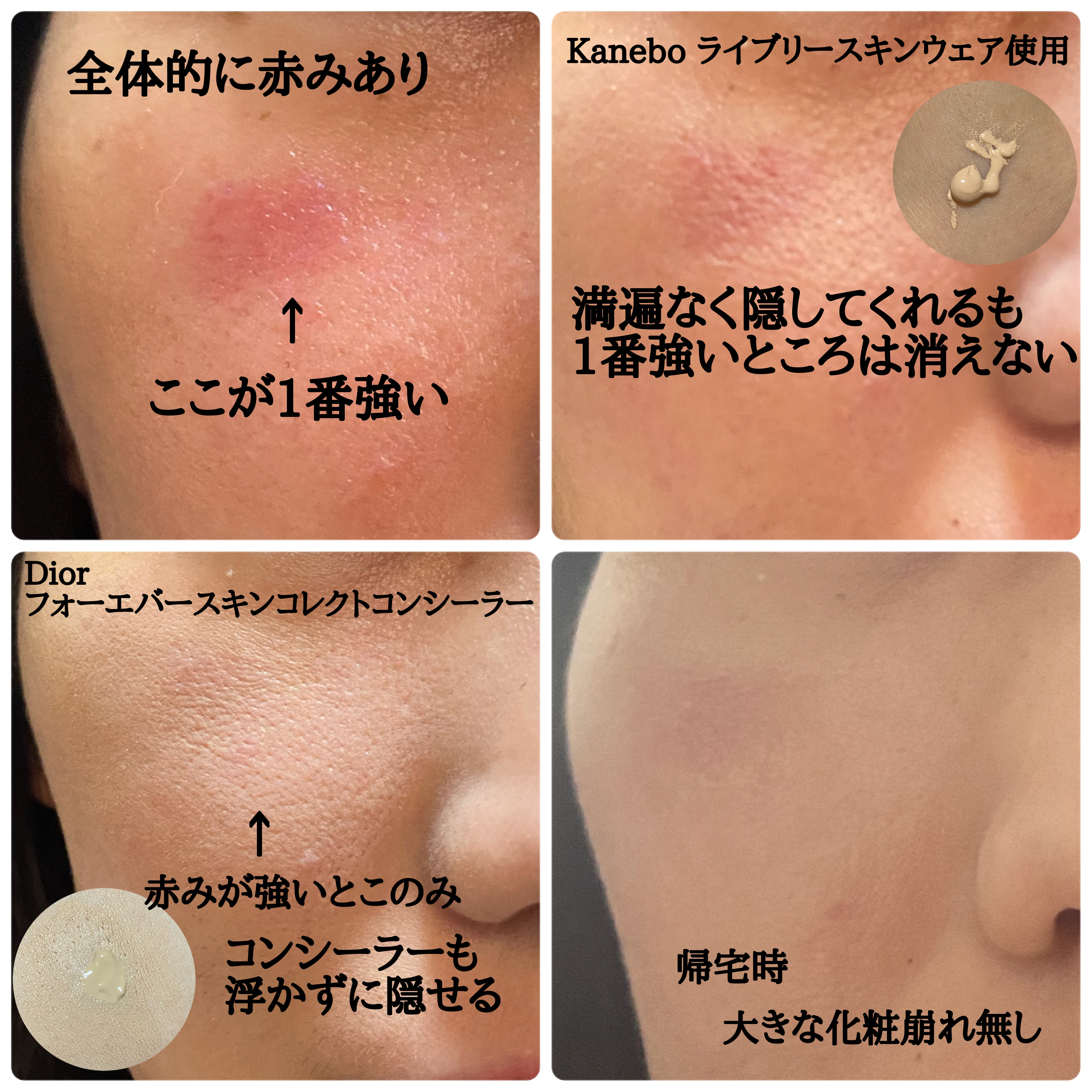 ディオールスキン フォーエヴァー スキン コレクト コンシーラー/Dior/リキッドコンシーラーを使ったクチコミ（2枚目）