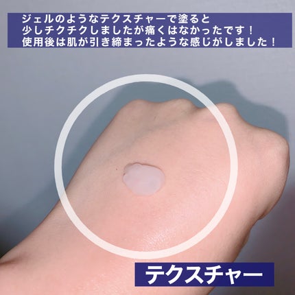 ゼロ1DAYエクソソームショット2000/MEDICUBE/美容液を使ったクチコミ(4枚目)