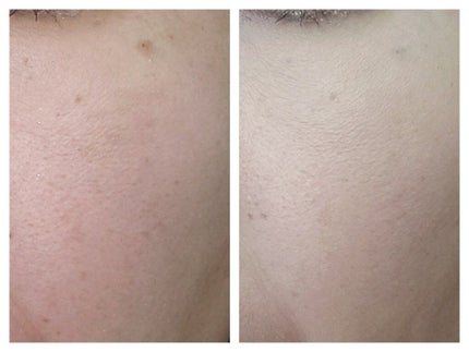 ライトフル C3 ナチュラル シルク パウダーファンデーション/M・A・C/パウダーファンデーションを使ったクチコミ(3枚目)