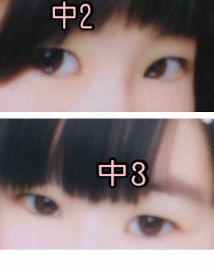 アイビューティー フィクサー WP/アストレア ヴィルゴ/二重まぶた用アイテムを使ったクチコミ(2枚目)