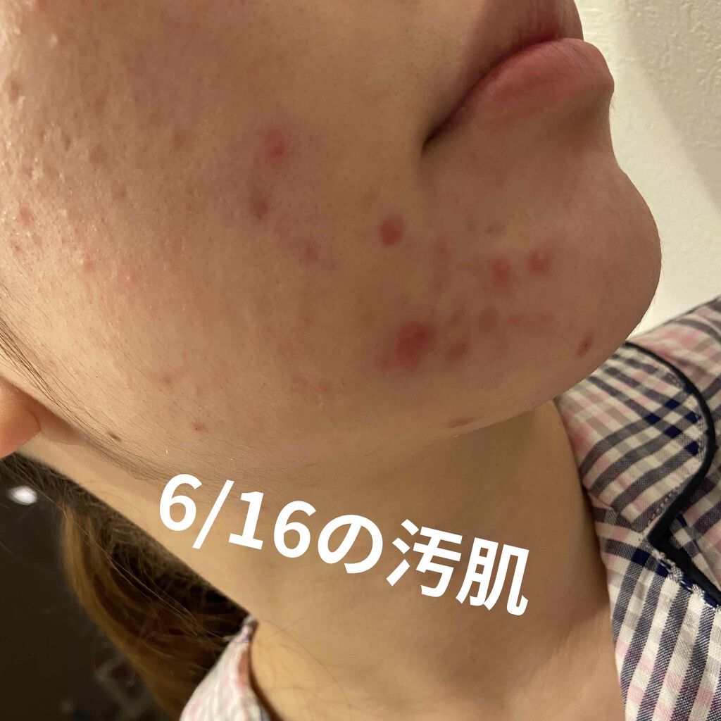 クリアウォッシュ/オルビス/洗顔フォームを使ったクチコミ(1枚目)