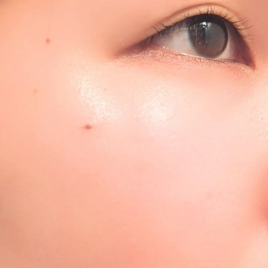 リードルショット100/VT/美容液を使ったクチコミ（3枚目）