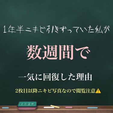 セイヤーズローズペタルウィッチヘーゼルトナー/セイヤーズ/化粧水を使ったクチコミ（1枚目）