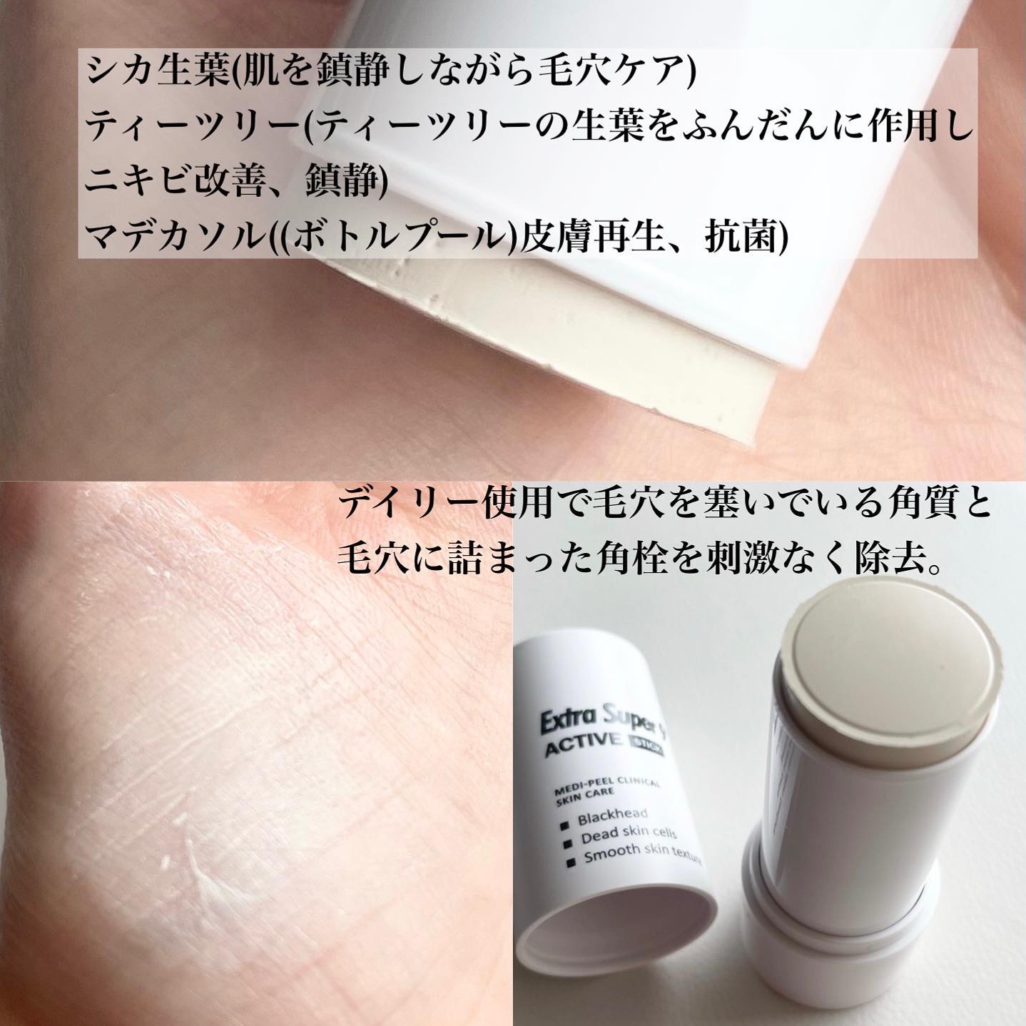 エクストラスーパー9プラス2.0/MEDIPEEL/ピーリングを使ったクチコミ（2枚目）