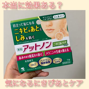 【アットノン ニキビあとケアジェル】

永遠と繰り返すニキビで赤い斑点が浮かび上がってしまっている頬に効果があると噂のアットノン ニキビあとケアジェルを使用してみました！


1ヶ月使ってみて感じたこと