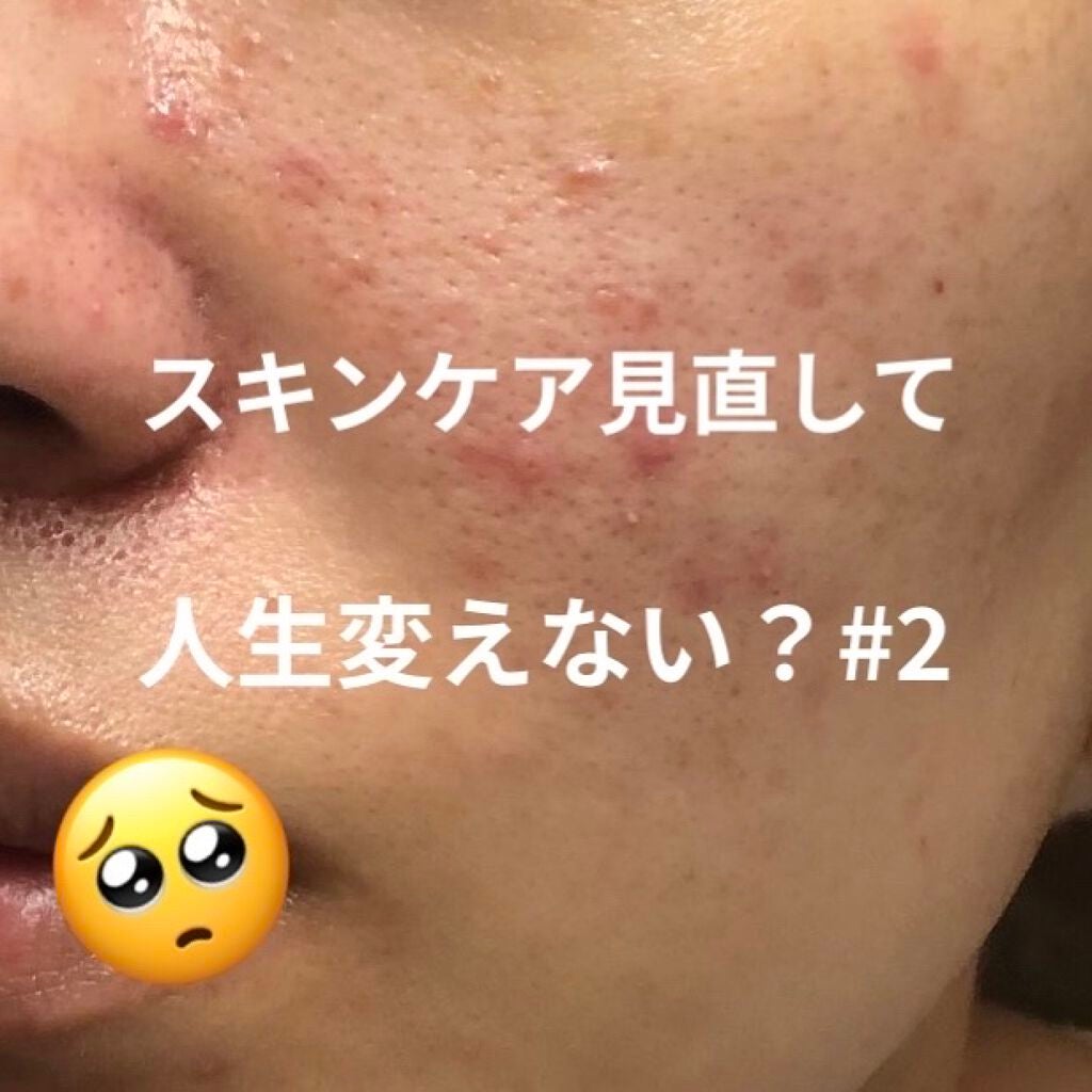 P.D.F A.Cドレッシングアンプルマスク EX/MEDIHEAL/シートマスク・パックを使ったクチコミ(1枚目)