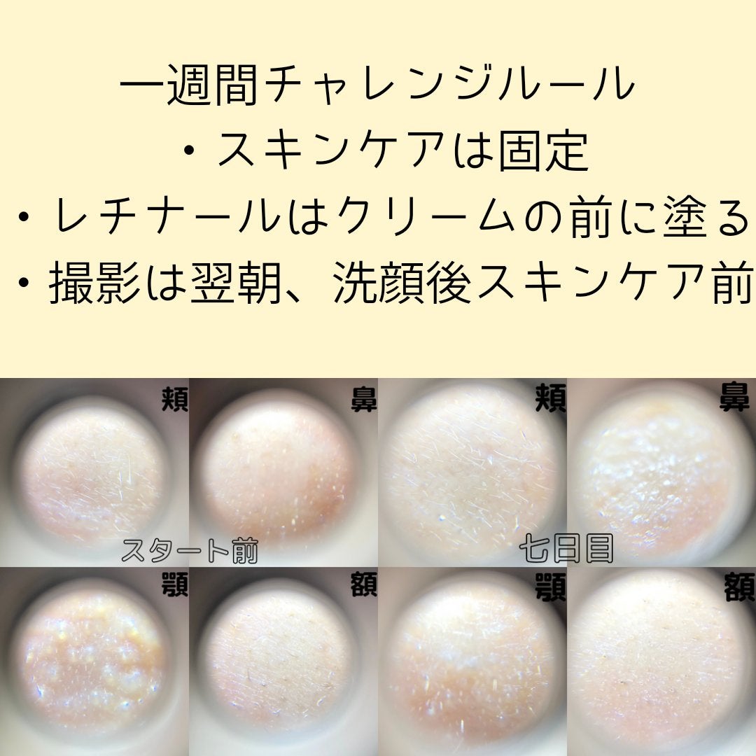 VITALIFT A forte/Dr.Different/フェイスクリームを使ったクチコミ(4枚目)