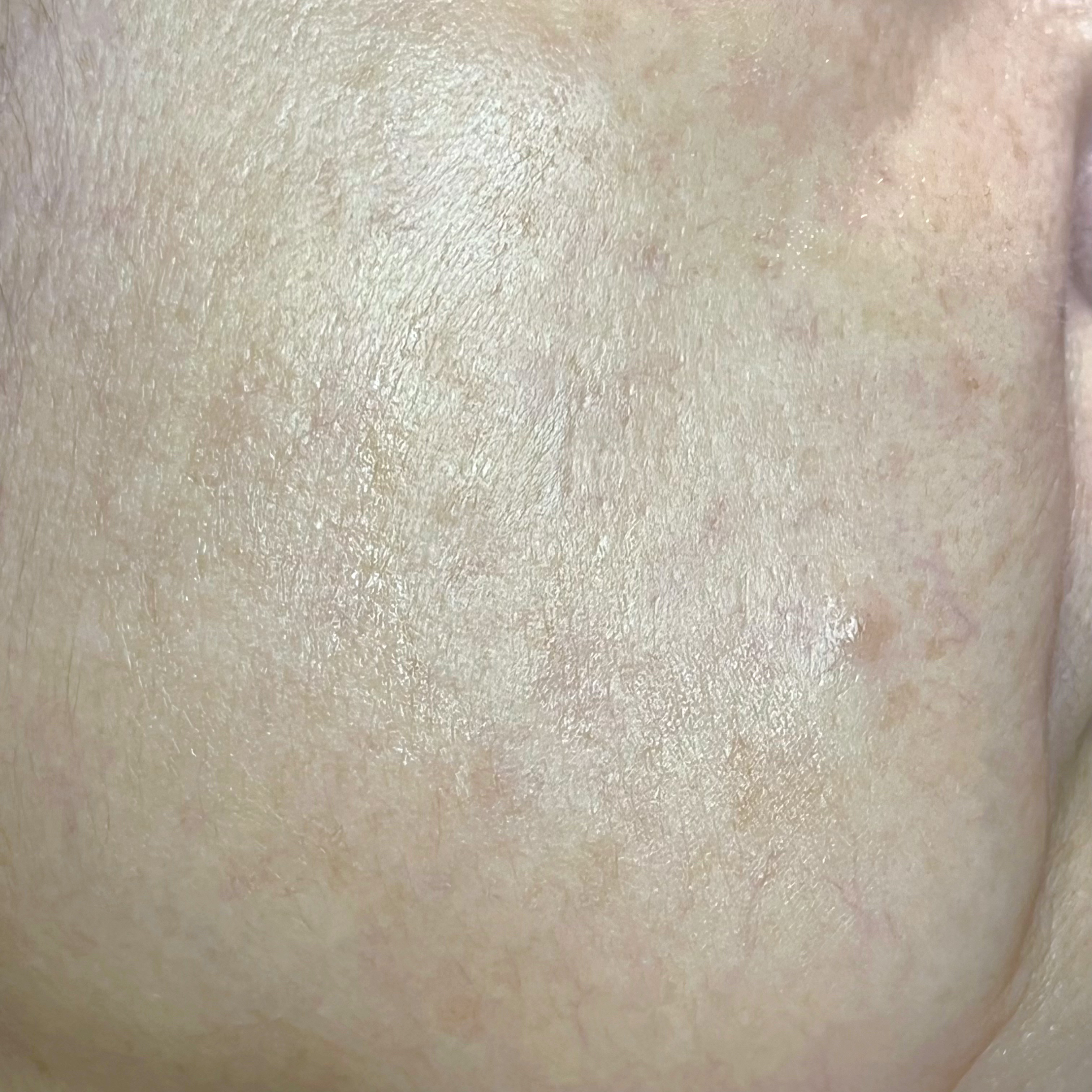 SRICHAND　スキンモイスチャーバースト セラム/SRICHAND/美容液を使ったクチコミ（3枚目）