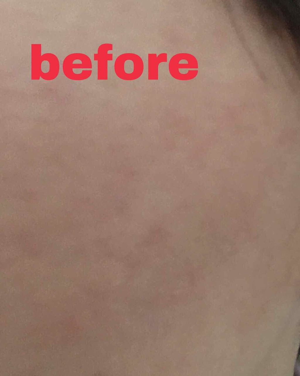 ドクタージャルト シカペア リカバー (第2世代)/Dr.Jart+/フェイスクリームを使ったクチコミ(3枚目)