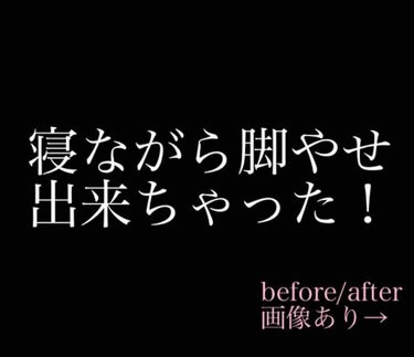 寝ながらメディキュット スパッツ 骨盤テーピング/メディキュット/レッグ・フットケアを使ったクチコミ（1枚目）