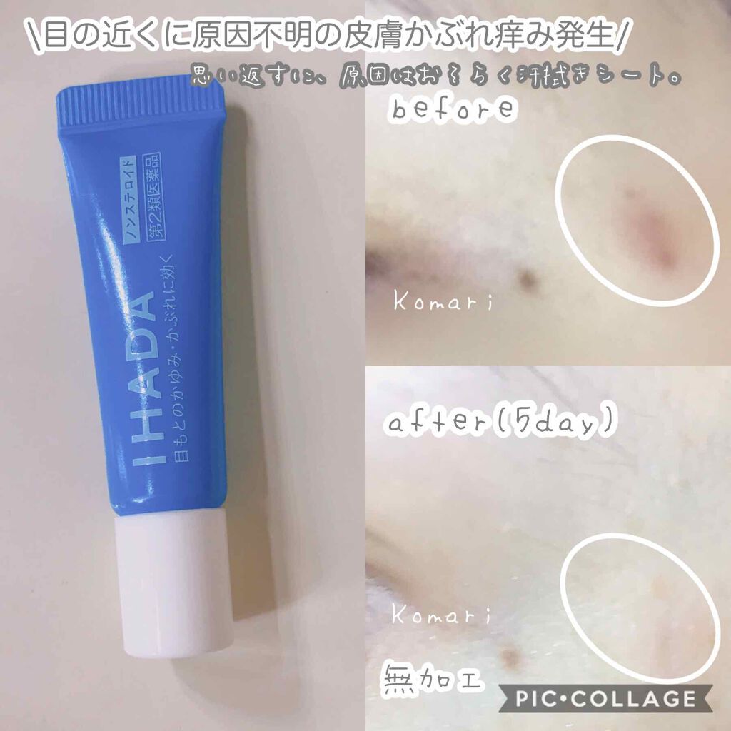 プリスクリードD(医薬品)/IHADA/その他を使ったクチコミ（2枚目）