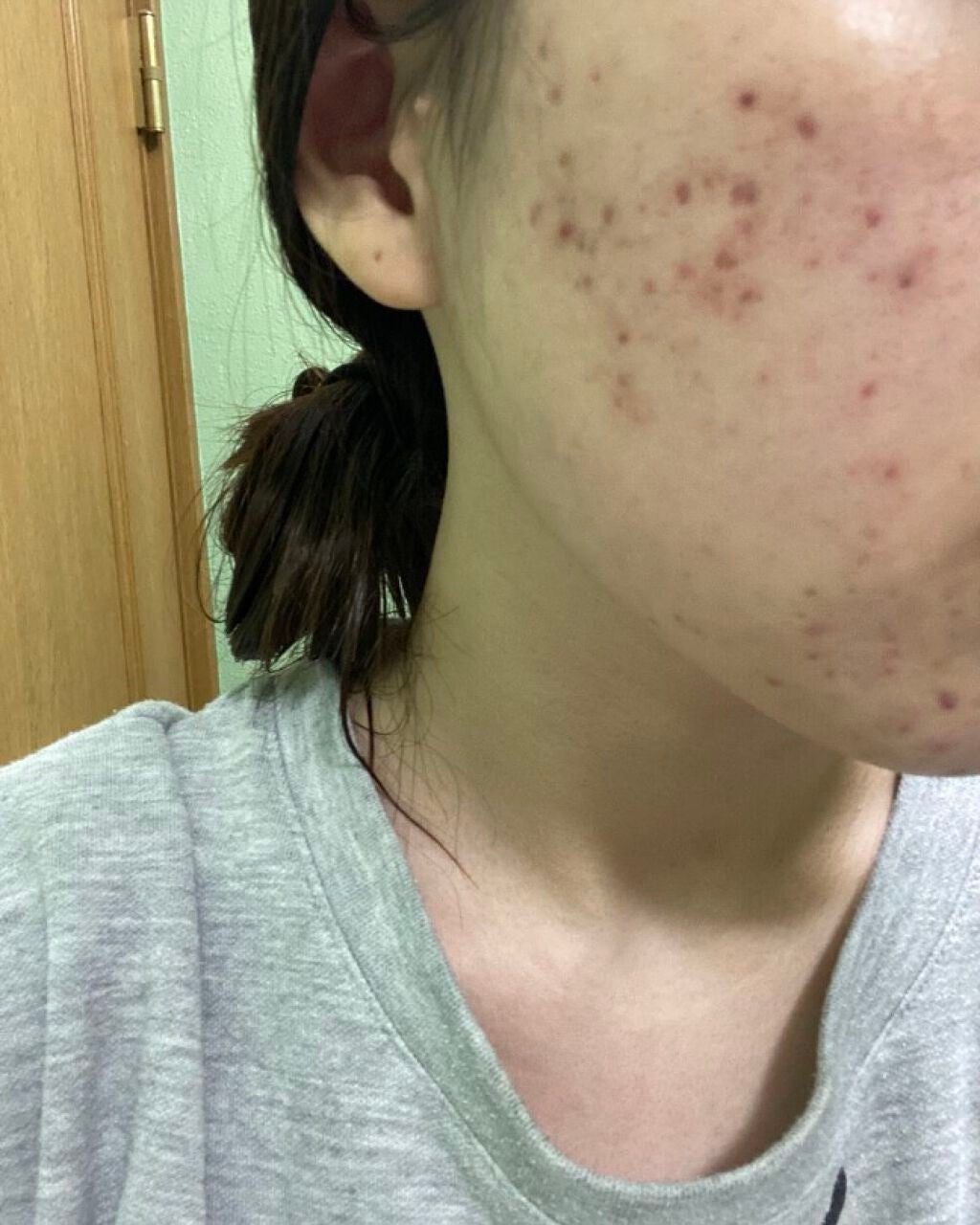 化粧水・敏感肌用・高保湿タイプ/無印良品/化粧水を使ったクチコミ(1枚目)