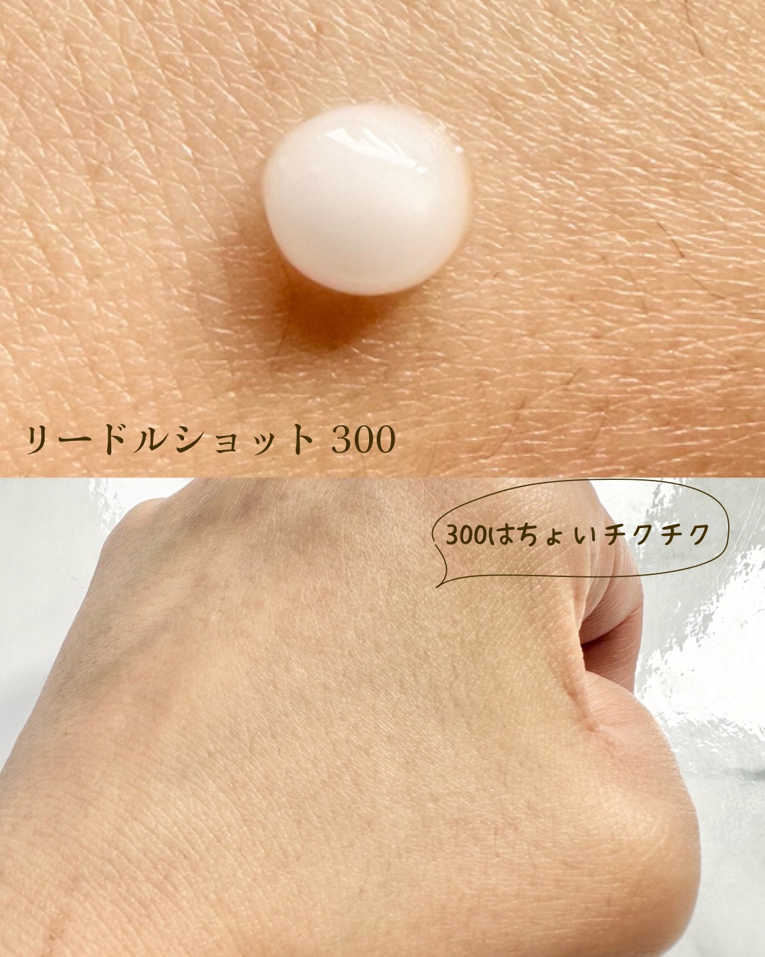 リードルショット300/VT/美容液を使ったクチコミ（3枚目）