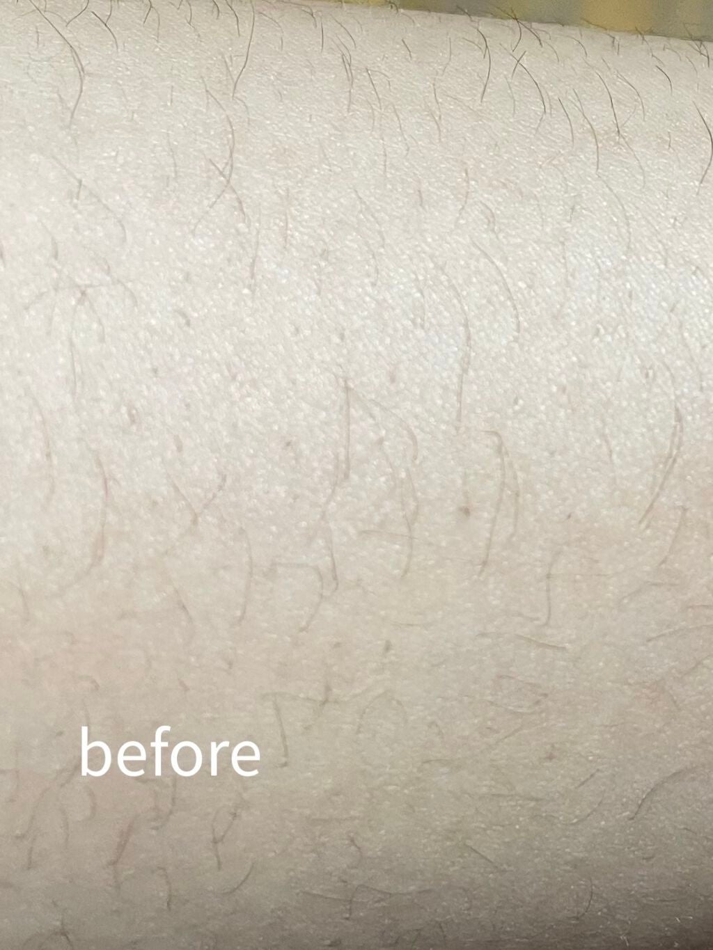 ãã¹ã¿ã€ã 逿¯ã¯ãªãŒã ææèçš/Veet/逿¯ã¯ãªãŒã ã䜿ã£ãã¯ãã³ãïŒ3æç®ïŒ