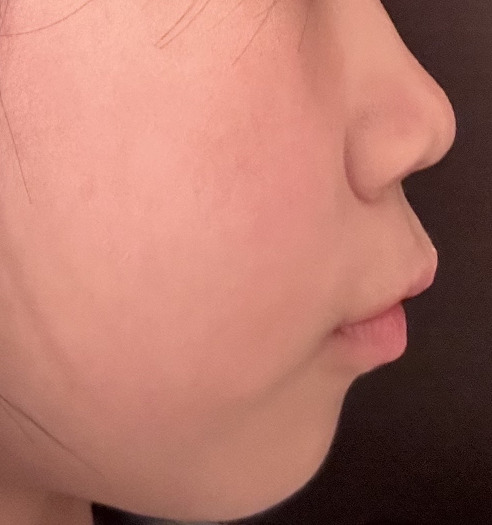 ノーズトレーナー/DAISO/その他スキンケアグッズを使ったクチコミ（3枚目）