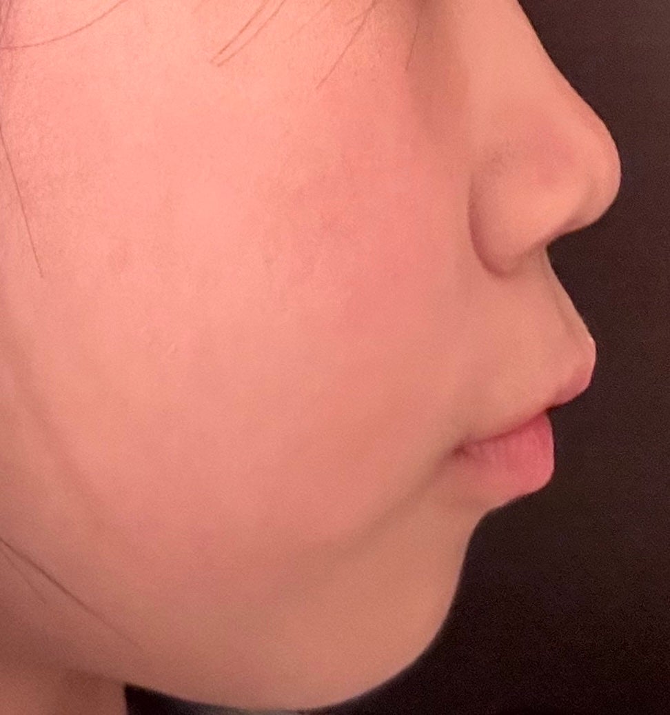 ノーズトレーナー/DAISO/その他スキンケアグッズを使ったクチコミ(3枚目)