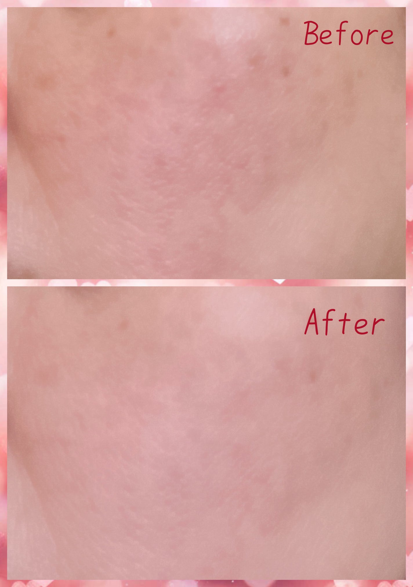 RGII インナーリフト UVエアリーフィット 美容液パウダー /ヴィブリアン エスプリーナ/プレストパウダーを使ったクチコミ(4枚目)