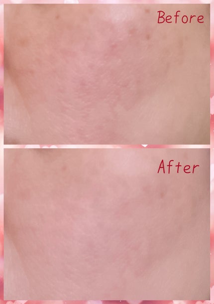 RGII インナーリフト UVエアリーフィット 美容液パウダー /ヴィブリアン エスプリーナ/プレストパウダーを使ったクチコミ(4枚目)