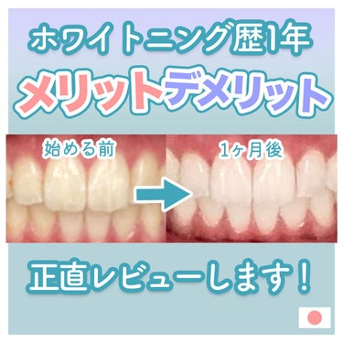 にほにうむ on LIPS 「🦷✨ホワイトニング1年の感想レポ✨🦷セルフホワイトニングに1年..」（1枚目）