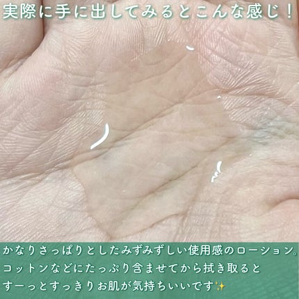 オードムーゲ 薬用ローション(ふきとり化粧水)/オードムーゲ/拭き取り化粧水を使ったクチコミ(3枚目)