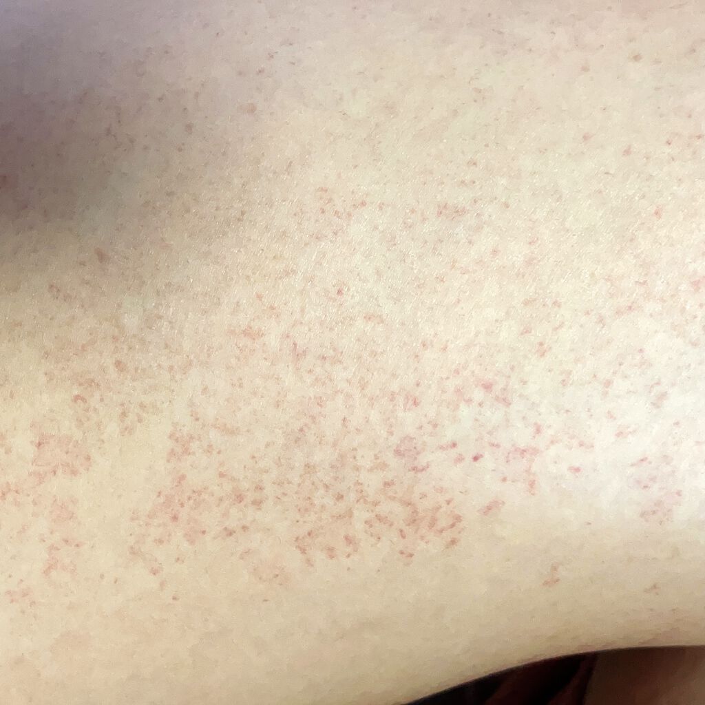 ジョンソンベビーオイル微香性/ジョンソンベビー/ボディオイルを使ったクチコミ（3枚目）