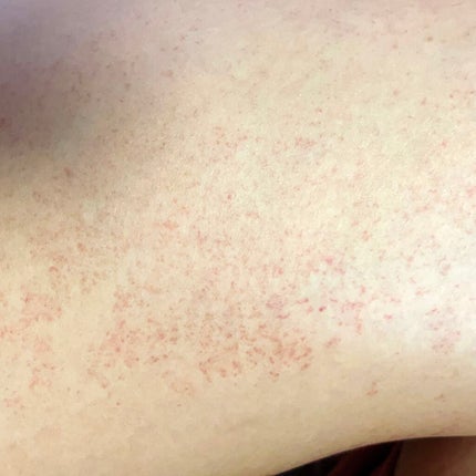 ジョンソンベビーオイル微香性/ジョンソンベビー/ボディオイルを使ったクチコミ(3枚目)