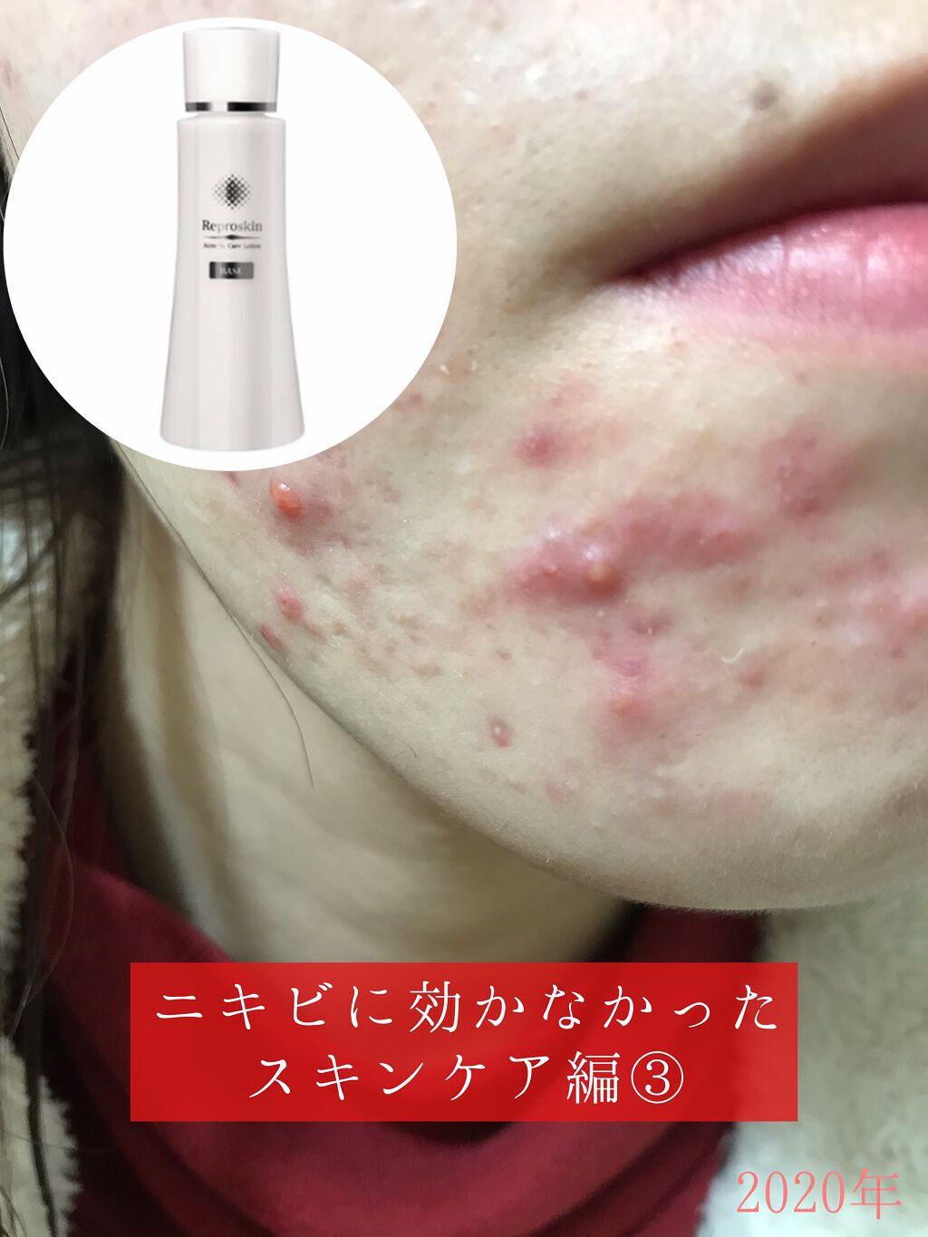 リプロスキン/Reproskin/ブースター・導入液を使ったクチコミ(1枚目)