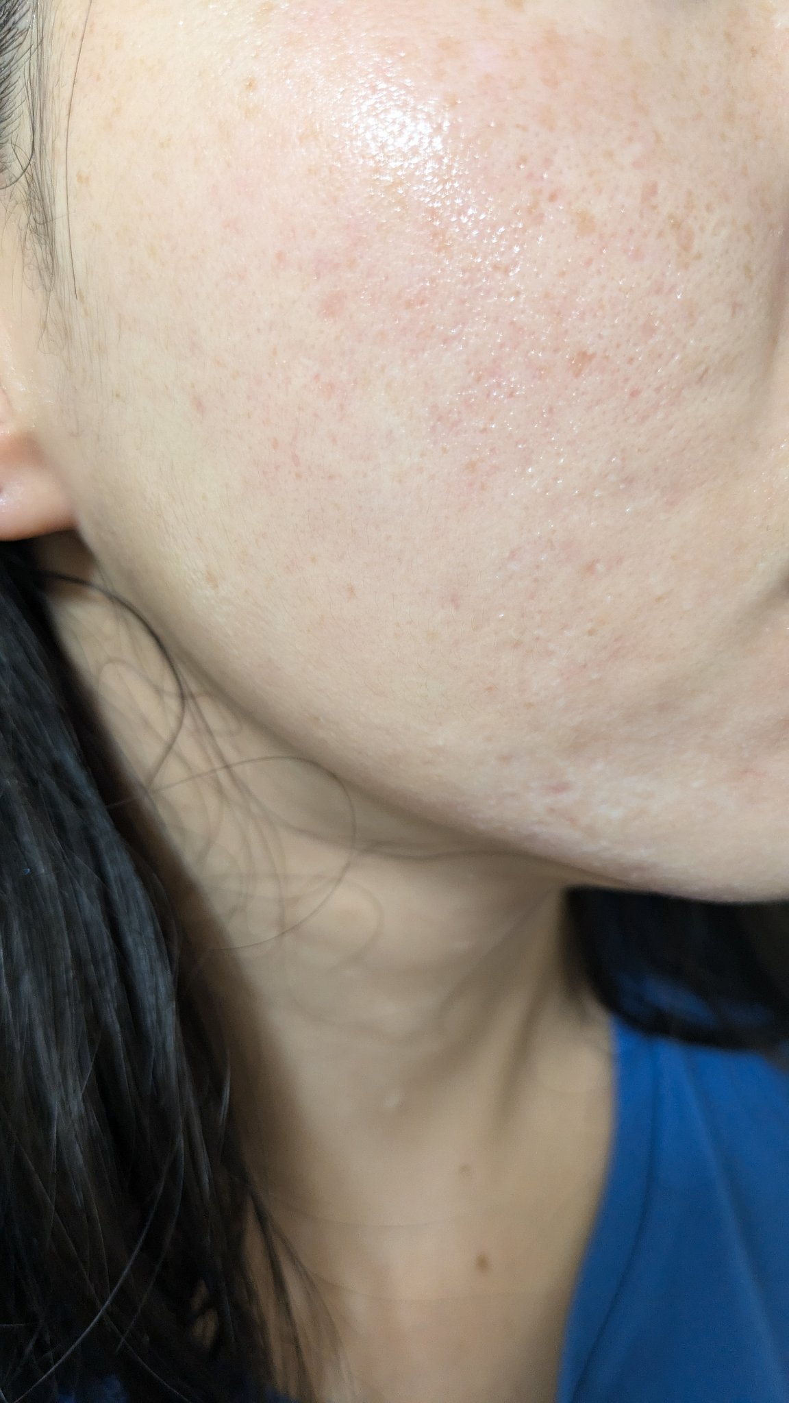 PLACENTREX EXTRACT GEL（ヒトプラセンタジェル）/Placentrex/その他を使ったクチコミ（1枚目）