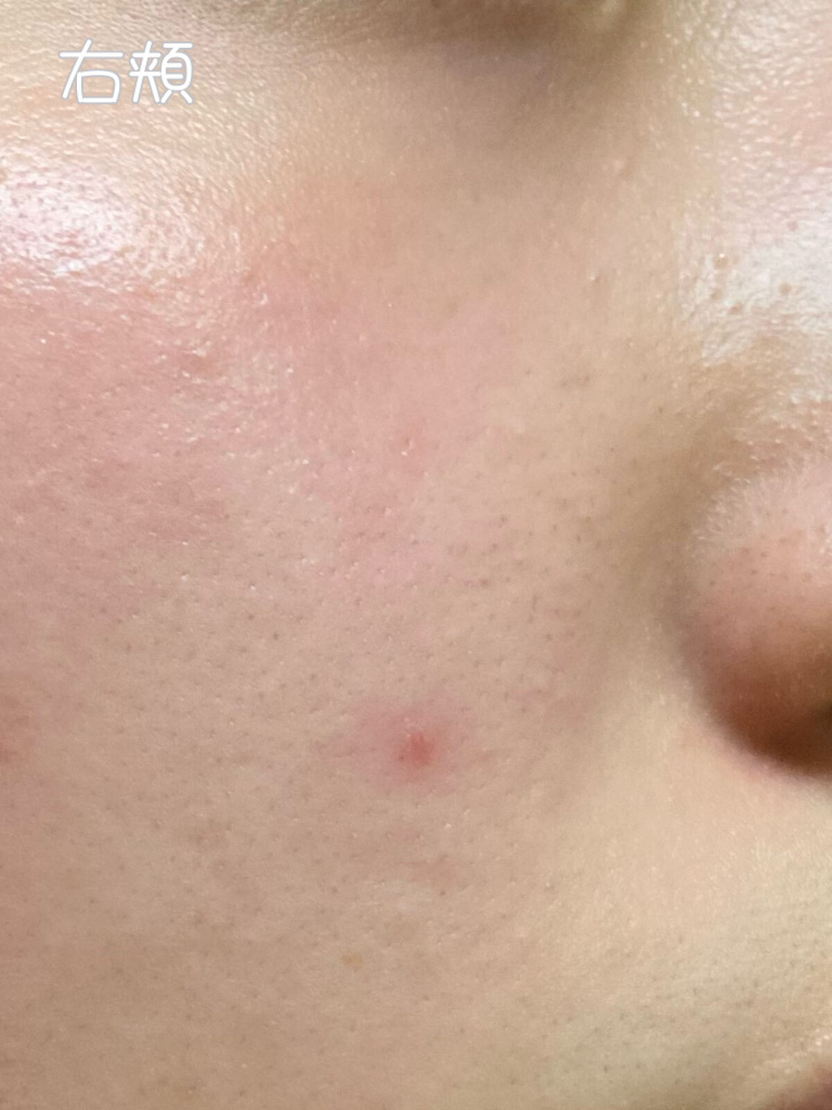 薬用しみ対策 美白化粧水 しっとりタイプ/メラノCC/化粧水を使ったクチコミ（3枚目）