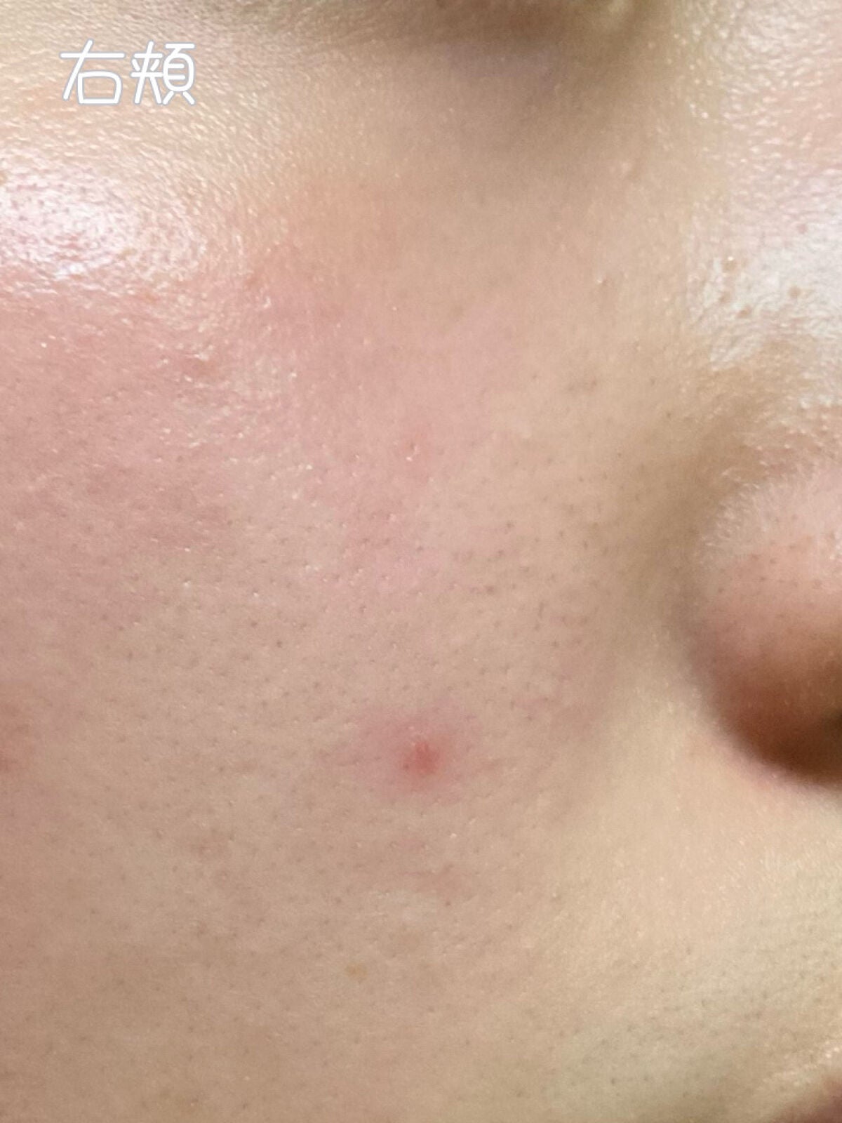 薬用しみ対策 美白化粧水 しっとりタイプ/メラノCC/化粧水を使ったクチコミ(3枚目)