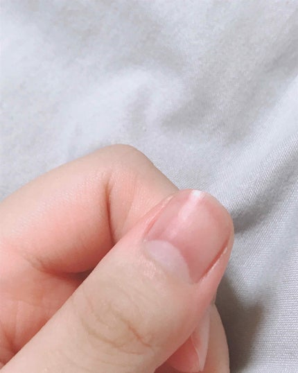 ウィンマックス キューティクルオイル/DAISO/ネイルオイル・トリートメントを使ったクチコミ(2枚目)