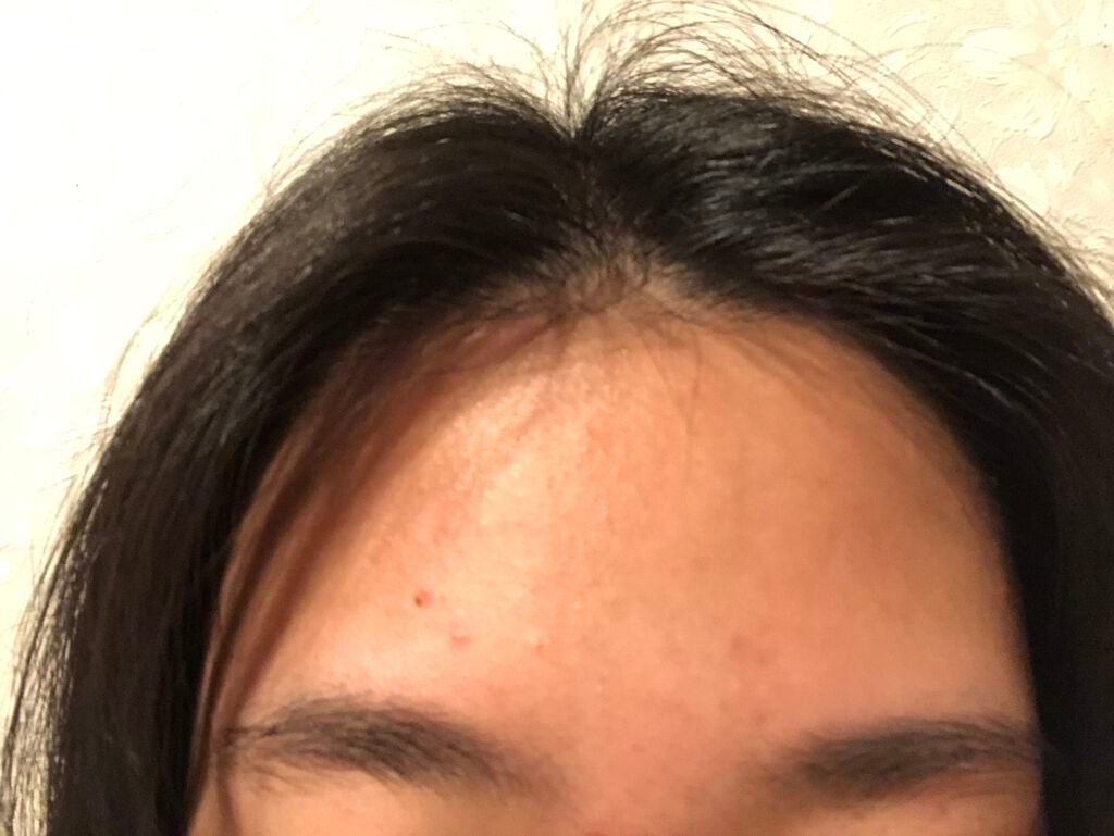 艶肌ドロップ/ラッシュ/美容液を使ったクチコミ(2枚目)