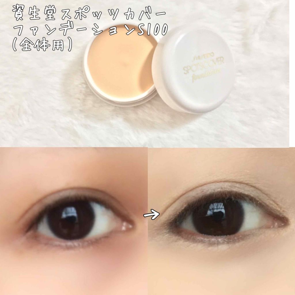 スポッツカバー ファウンデイション/SHISEIDO/クリームコンシーラーを使ったクチコミ(1枚目)