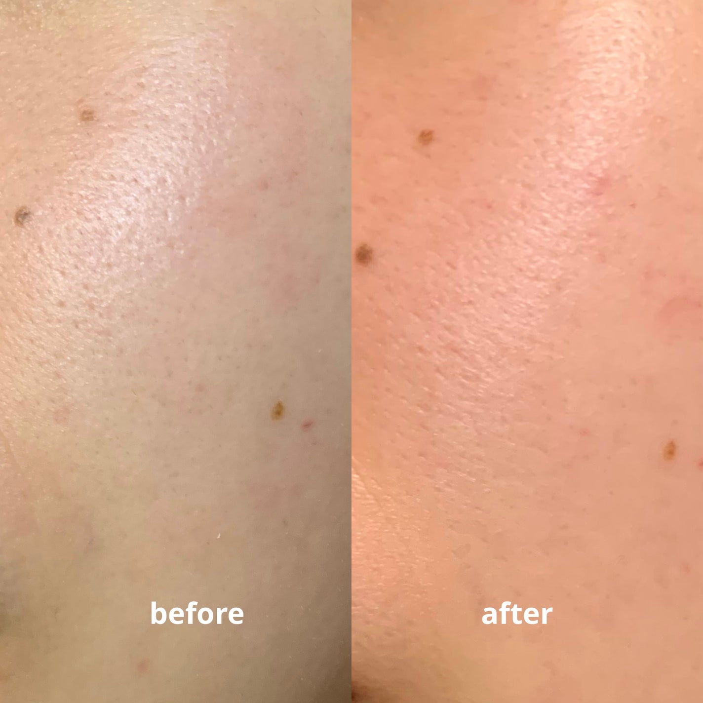 リードルショット300/VT/美容液を使ったクチコミ(5枚目)