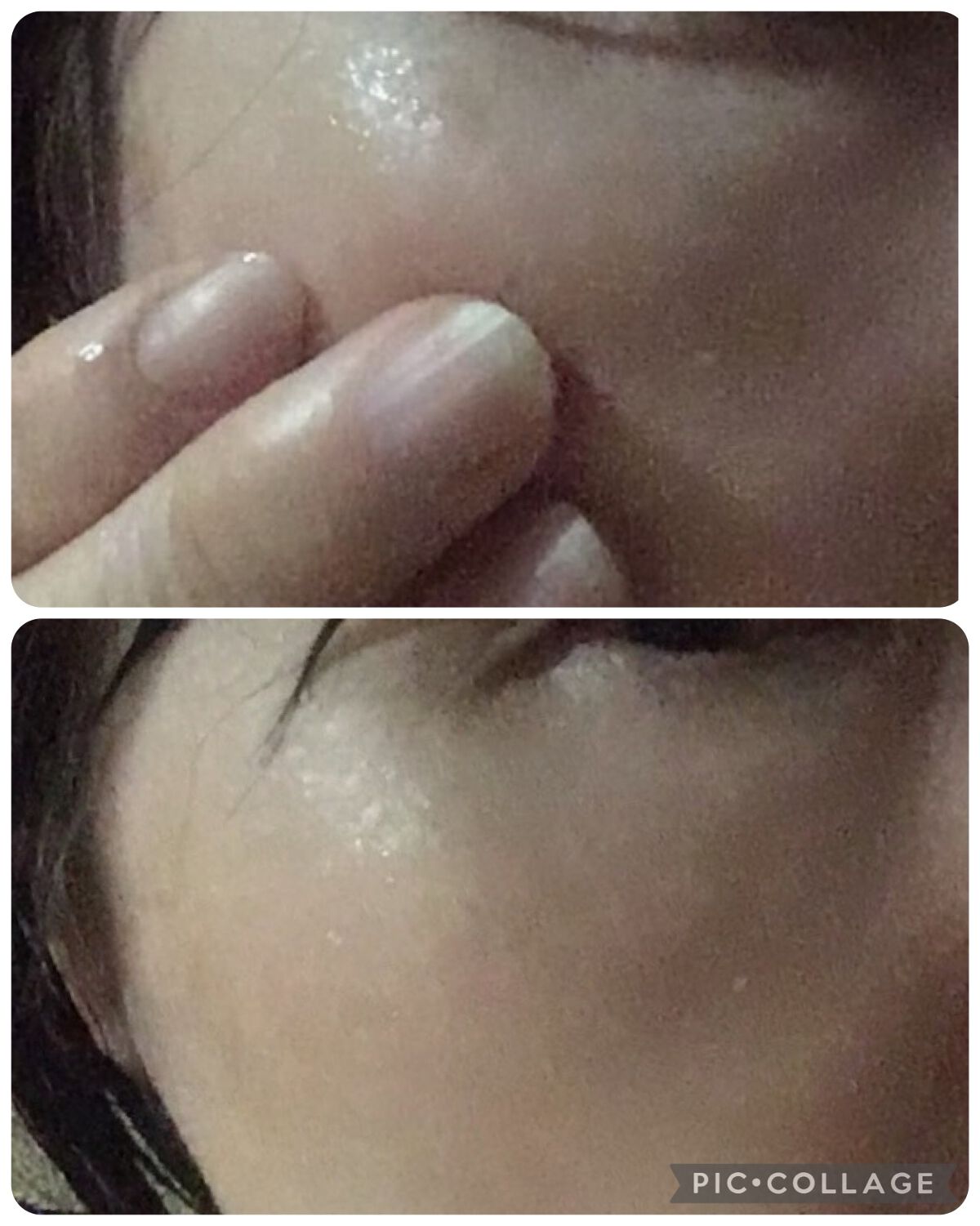 ナイトセラム /リバイタル/美容液を使ったクチコミ(1枚目)