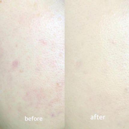 ピンクティーツリーカバークッション/APLIN/クッションファンデーションを使ったクチコミ(3枚目)