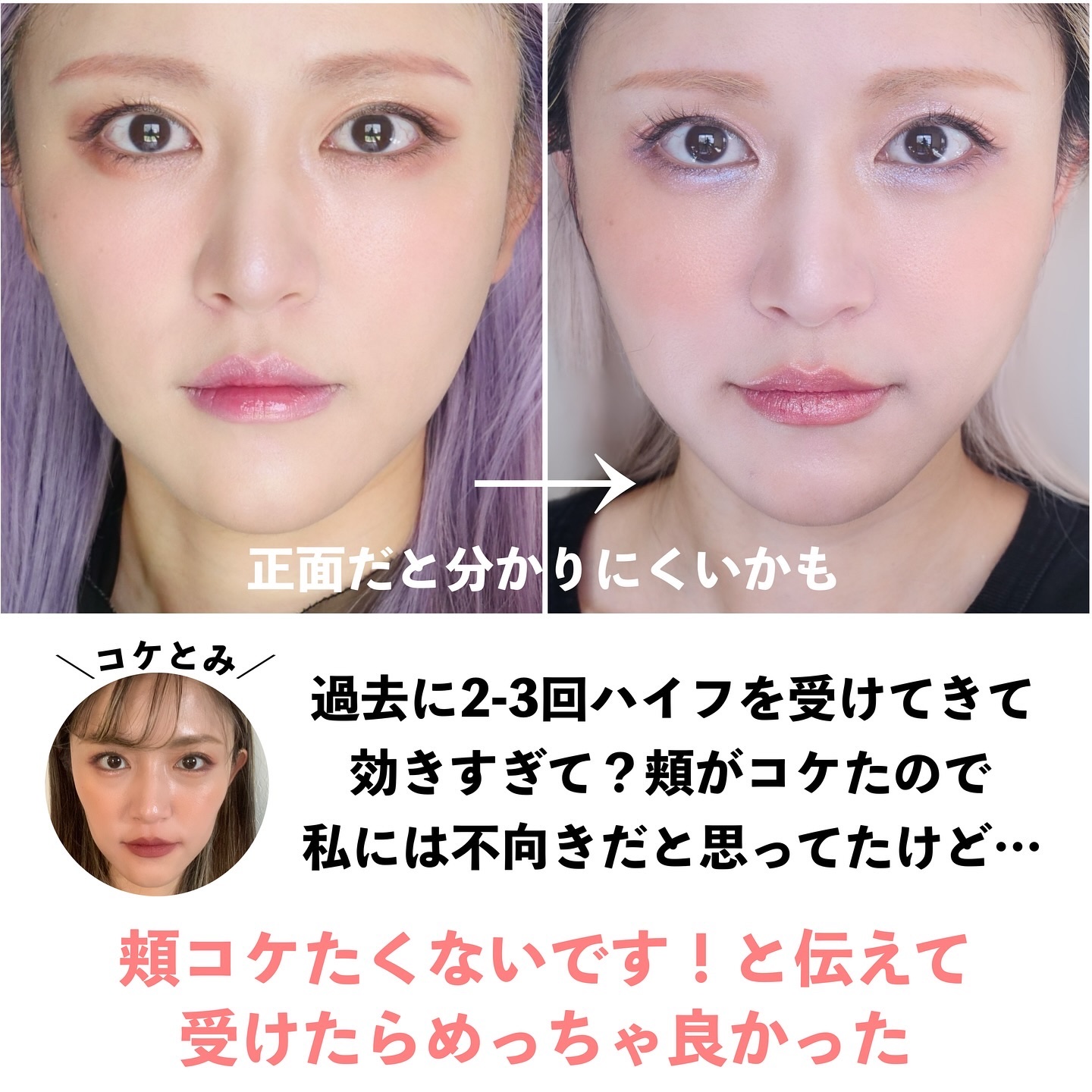 を使ったクチコミ（2枚目）